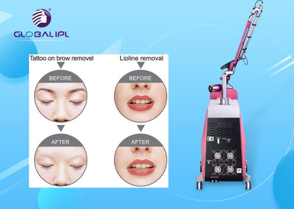 Pico Laser ND YAG Laser Machine Tattoo Removal Skin Therapy 1064nm / 532nm
