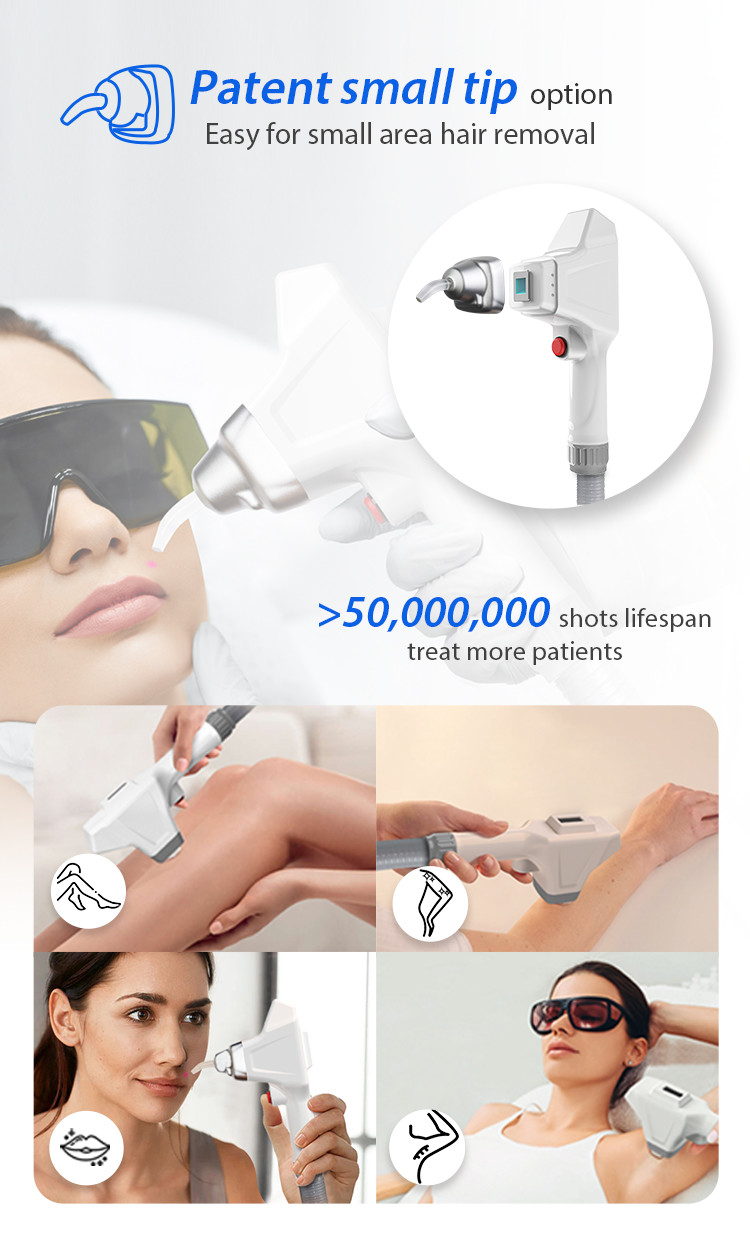 Лазер прочное Handpiece и длинная продолжительность жизни волокна прибора лазера удаления волос