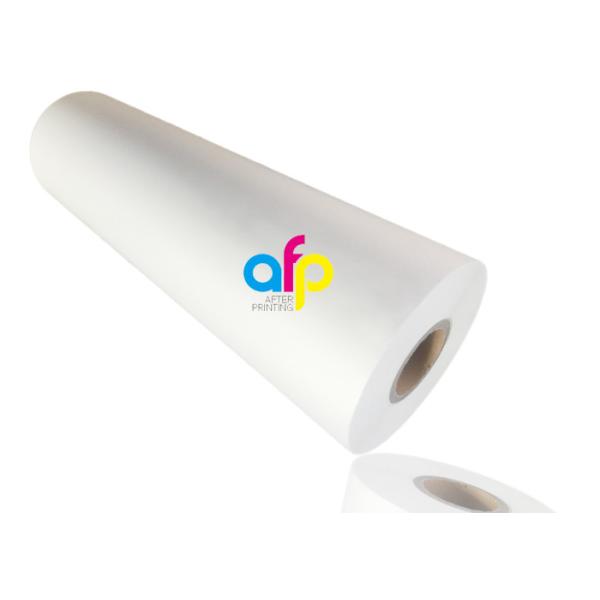 Обработка короны сторон двойника фильма слоения БВ УЛЬТРАФИОЛЕТОВАЯ исчезая штейновая