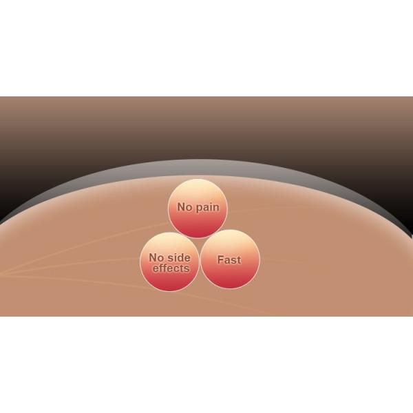 New Style OPT / IPL RF Beauty Equipment SHR IPL Hair Removal 10MHz RF Frequency