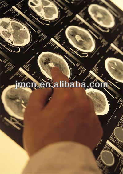 Double Layer DT2B Medical Dry Film X Ray For Agfa Thermal Printer