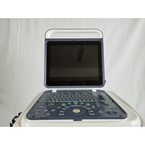 Hospital Outside 2020 New Portable Digital 15 Inch Color Doppler Ultrasound Machine