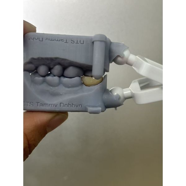 Full Zirconia Crown - High Strength Biocompatible Dental Crown for Durability