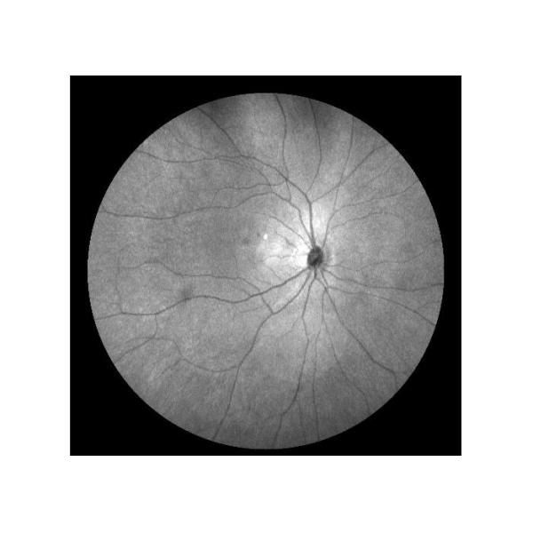 Equipo oftálmico de Angiograph Digital 160° de la retina