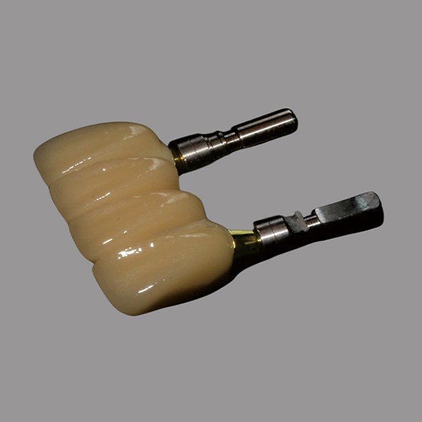 Gold Plating Nitrogen Titanium Abutments Dental Implants Cad/Cam Compatibility