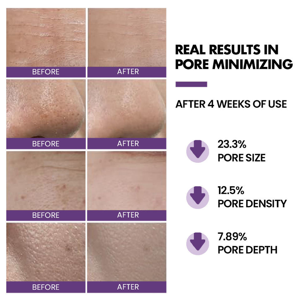 OEM OEM Shrink Pore Facial Toner spray Wholesale Skin Care Products Pore Minimization Facial Toner Facial spray