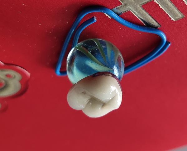 Dental Lab Product CAD CAM PFM Crown porcelain fused to metal