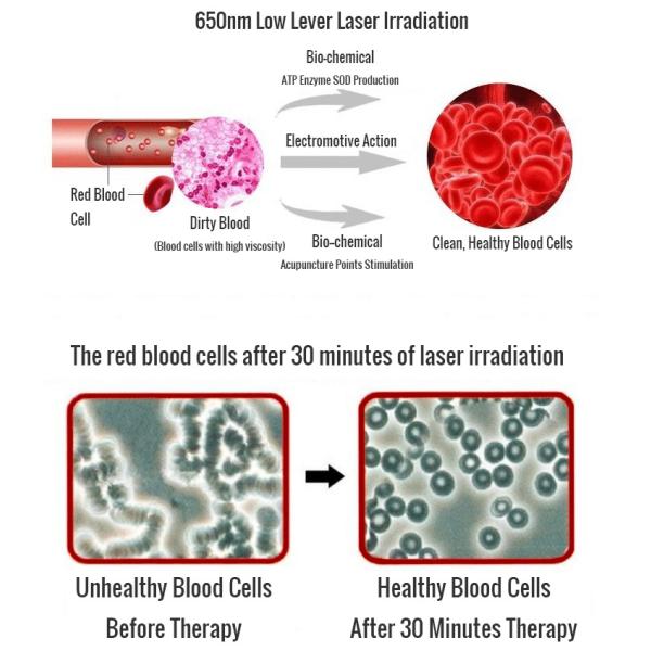 500mah Nano Wave Instrument Wrist Laser Therapy Instrument