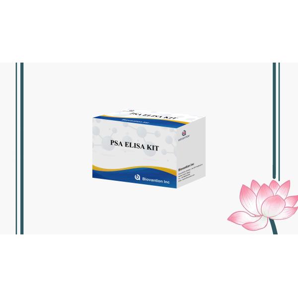 Um Kit de Teste PSA Elisa para Antígeno Específico da Próstata, Imunossorbente ligado à Enzima PSA