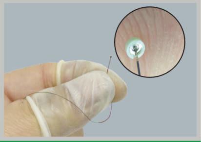 High Precision micro welding medical device for OEM contract manufacturing