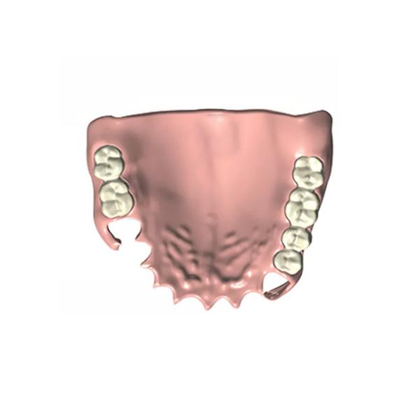 High Chewing Efficiency Denture Dental Lab CAD / CAM Fixed Partial Denture