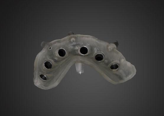Surgical sguide Plan for Implant Supported Crown Design and Alveolar Bone Information