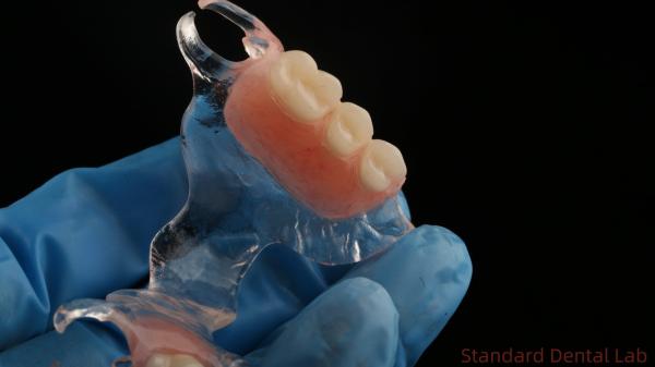 Estrutura de metal fundido transparente flexível Dentes parciais Alta estética Perfeito ajuste