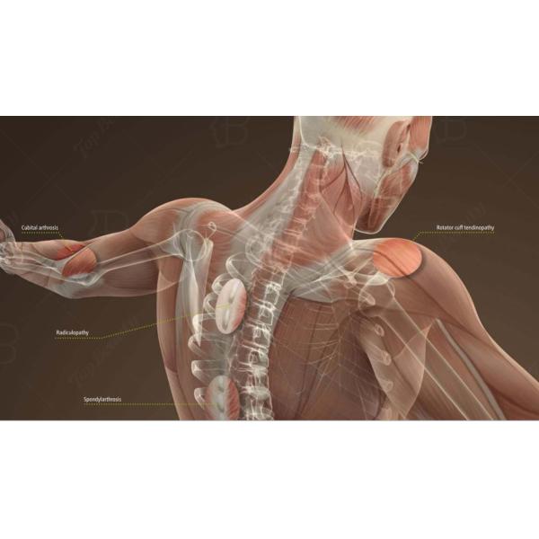 3000 Гц экстракорпоральный магнитный терапевтический аппарат EMTT поле обезболивающее PEMF