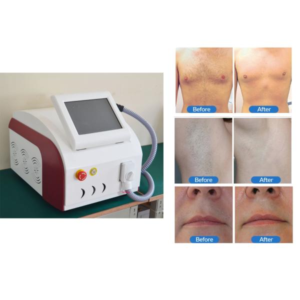 Diode Laser Hair Removal Equipment With Medical Eye Goggles And Glasses