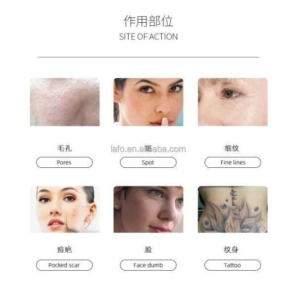 Salon Use 808nm Diode Laser Hair Removal Laser Body Hair Remover Professional