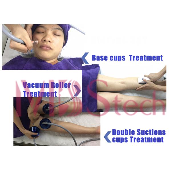 Машина RF ролика вакуума подниматься стороны