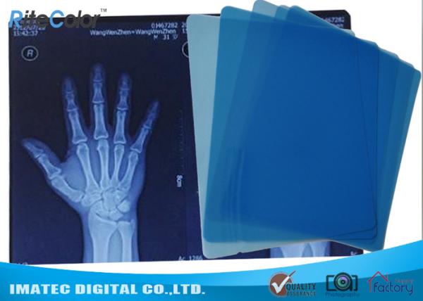 Inkjet Imaging Medical Blue Sensitive X Ray Film 200 Micron Thickenss