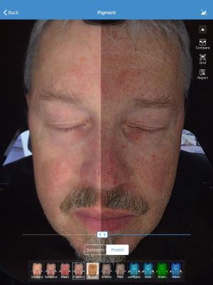 Armazenamento facial de Visia 32gb do varredor do analisador da pele 3d para o doutor Pele Clínica