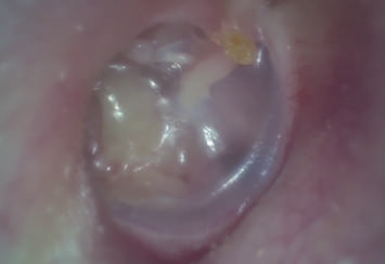 Отоскопии Otoscope USB система цифровой фотокамеры Endoscope видео- видео- медицинская с записанными фото и видео