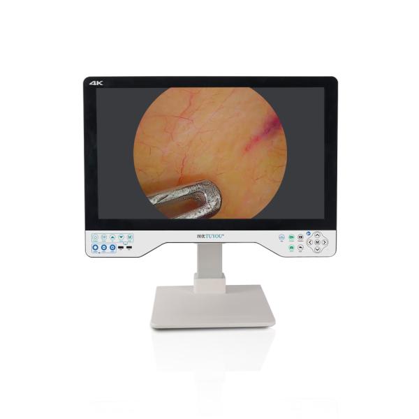 CE ISO13485 Certified 24 Inch UHD 4K Medical Endoscopic Camera System with SONY CMOS Sensor and 256GB Storage
