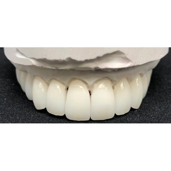 Pre Shaded Multilayer Zirconia Blocks Dental B1 D98*14mm Open Systems Compatible
