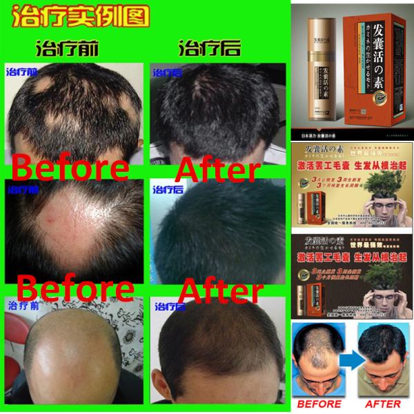 hair treatment Hair Growth Essence anti hair Loss Liquid dense unix hair conditioner Serum