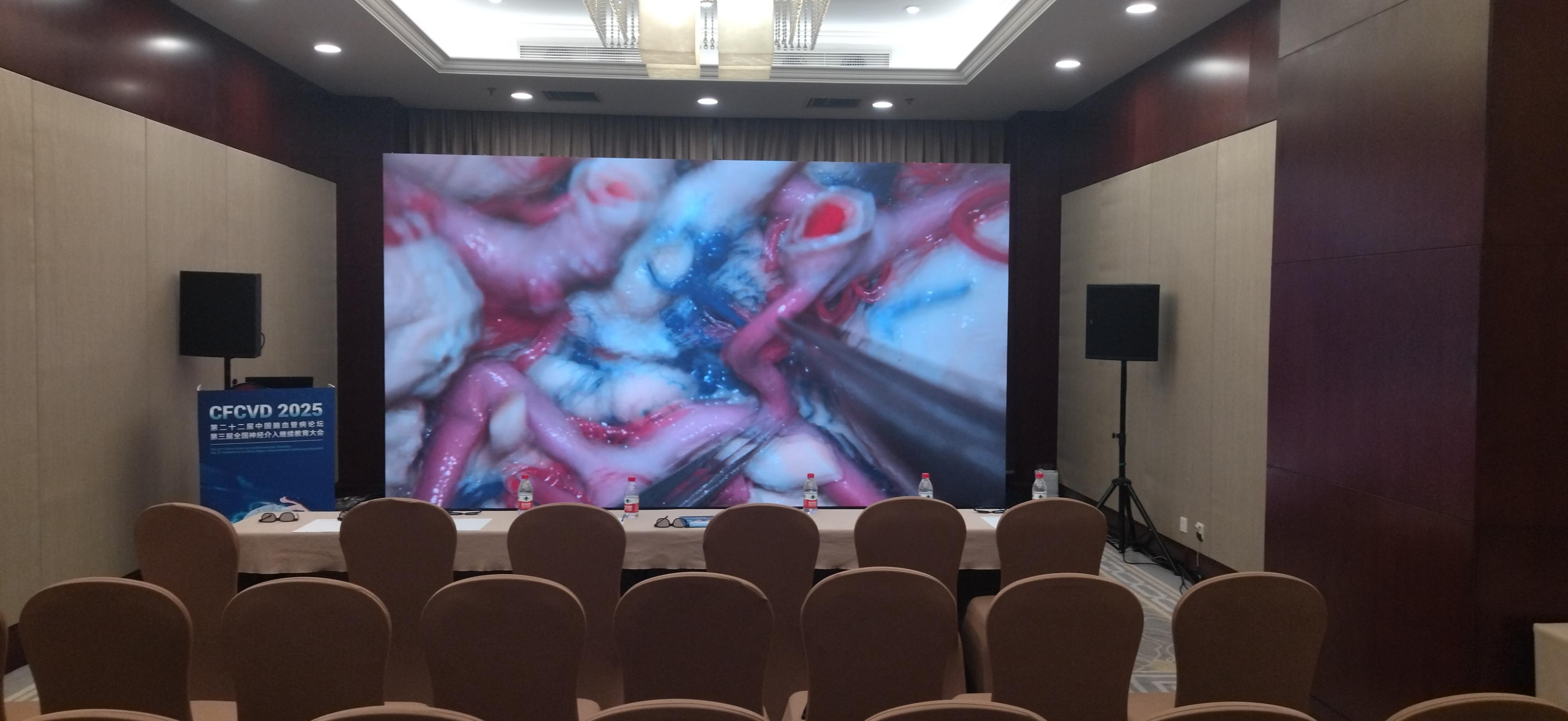 High Contrast Polarized 3D Screen for 3D Medical Image Analysis & Research