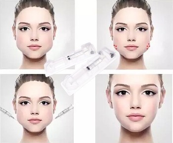 заполнитель Хялуроник кислоты 1.0мл лицевой, гель Хялуроник кислоты впрыски для стороны