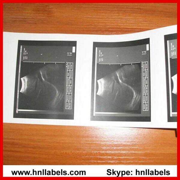 Ultrasonic Paper Compatible UPP-110s Medical Printing Media(Upp-110s Paper)