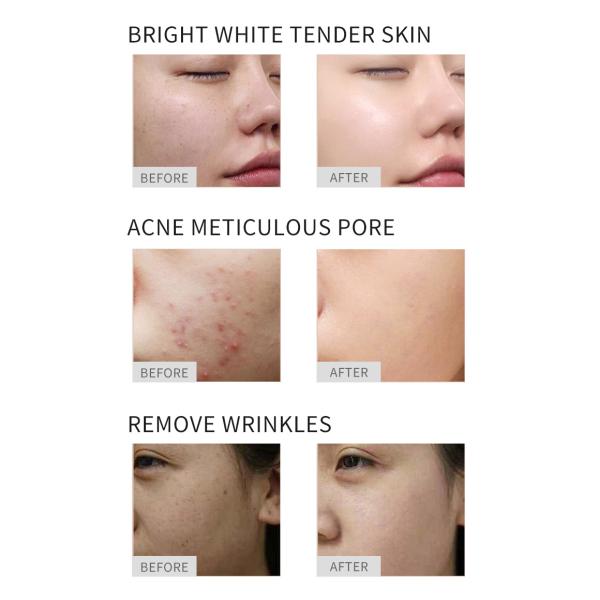 Pdt привело красного света машины подмолаживания кожи терапией фотона 7 цветов оборудование заботы красоты кожи лицевого фотодинамическое