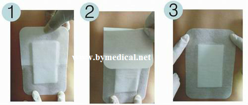 Hypoallergenic Medical Wound Dressing Bandage , First Aid Plaster Wound Care Pad