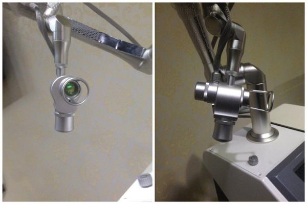 UltraPulse RF Tube Fractional CO2 Laser Vaginal Tightening/Skin Resurfacing Unit NBW-FII
