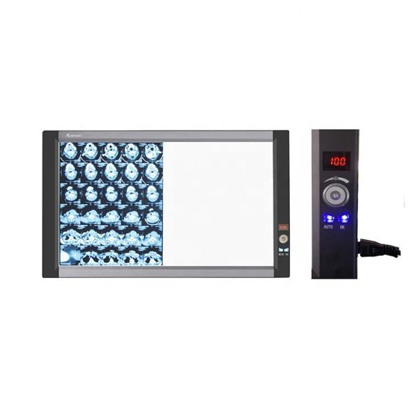 Hot Sale Manufacturer Supply LED Medical X-ray Film Viewer