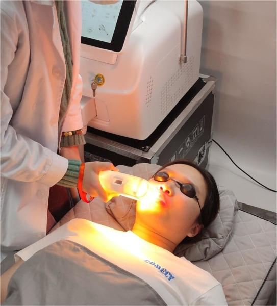 Máquina portátil de redução de pelos da pele para lesões vasculares e remoção de manchas faciais