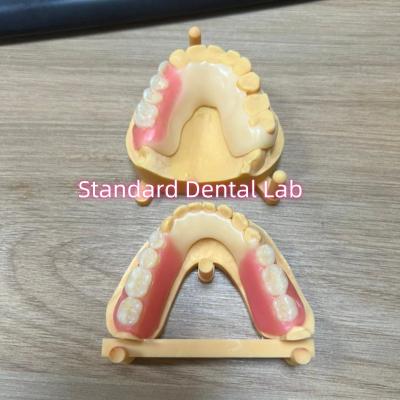Tinta de dente estética Estrutura acetalo Tintas de cor de dente Ivoclar