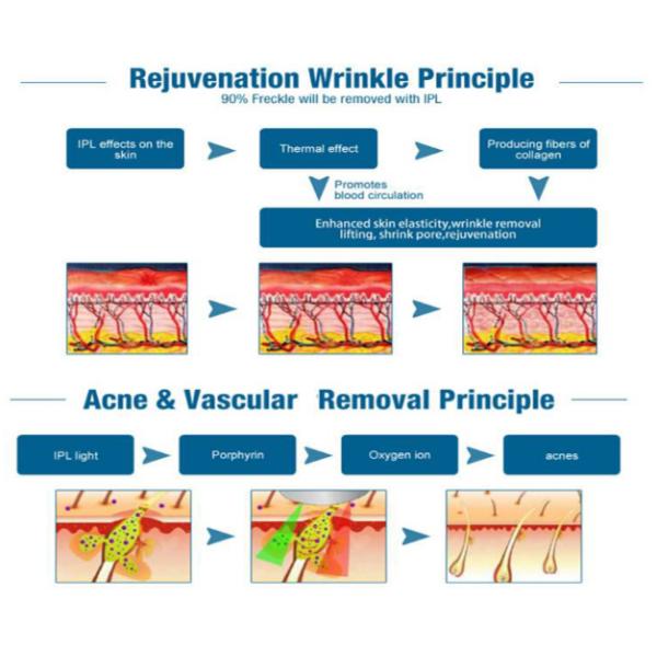 Multifunctional Laser Hair Removal Device , Ipl Machine For Skin Rejuvenation -5 - 0℃ Skin Cooling