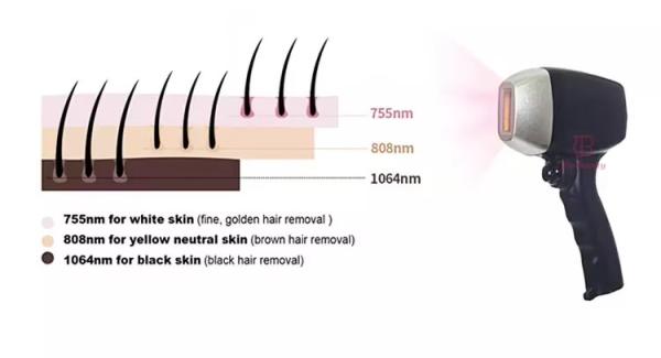 2 IN 1 YAG 4 Wavelength Hair Removal Alexandrite Laser Diode Laser Hair Removal Machine