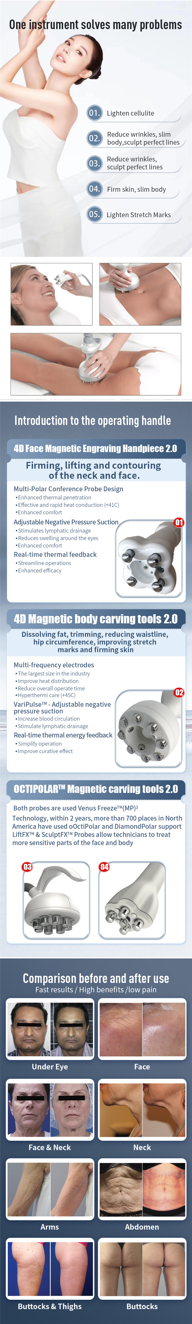 Multipolar RF Slimming Skin Beauty Machine For Skin Tightening Body Contouring