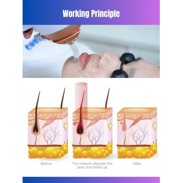 2024 Glory Pro 4 в 1 Постоянный диодный лазерный эпилятор 808nm 755nm 940nm 1064nm Красотка для омоложения кожи