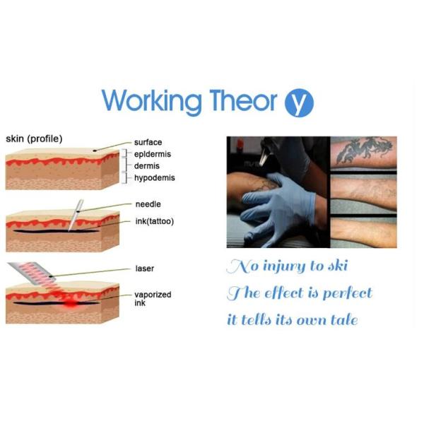 Прибор 1 удаления татуировки лазера НД Яг клиники - 1000мДж доказанная плотность энергии ИСО13485