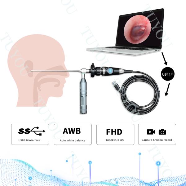TUYOU USB3.0 Use On Laptop Portable Endoscope Camera For ENT Video Endoscopy Check