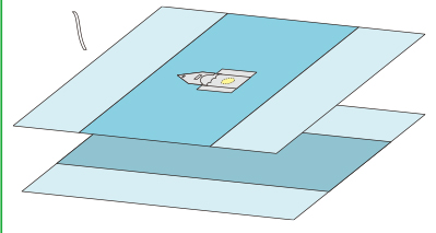 Ophthalmic Soft Non Woven Sterile Surgical Packs Water Impermeable