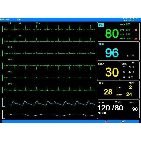 PDJ-3000 портативный многопараметровый пациентский монитор ICU