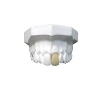 Matériel biologique de Technologie de pointe de bonne de Biocompatibility couronne dentaire de porcelaine