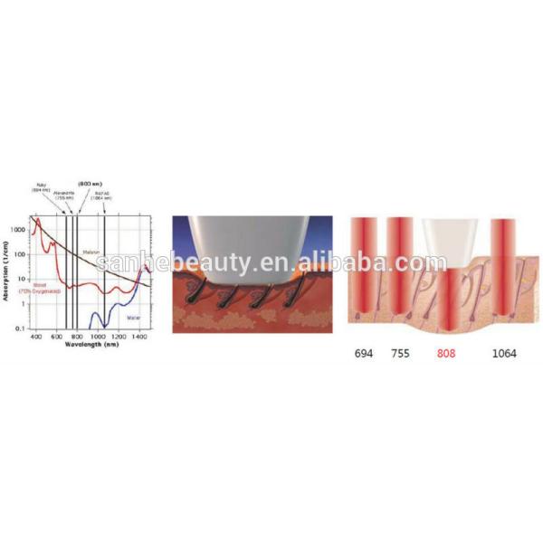 Germany import 808nm diode laser hair removal, permanent hair removal machine