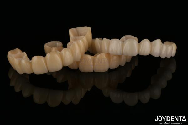 Natural Looking Porcelain Layered Zirconia Bridges Wear Resistance High Biocompatibility