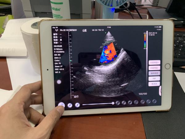 Wireless Phased Array Ultrasound Transducer Handheld Cardiac Echography Wireless Ultrasound Probe Price for Sale