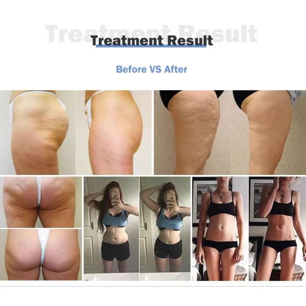 New arrival beauty equipment vacuum roller massage body slimming device