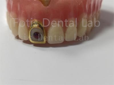 Comfortable Full Acrylic Denture For Professionals Stain / Odor Resistant